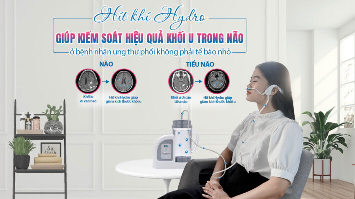 thumbnail-hi-t-khi-hydro-giu-p-kie-m-soa-t-hie-u-qua-kho-i-u-trong-na-o-o-be-nh-nha-n-ung-thu-pho-i-kho-ng-pha-i-te-ba-o-nho